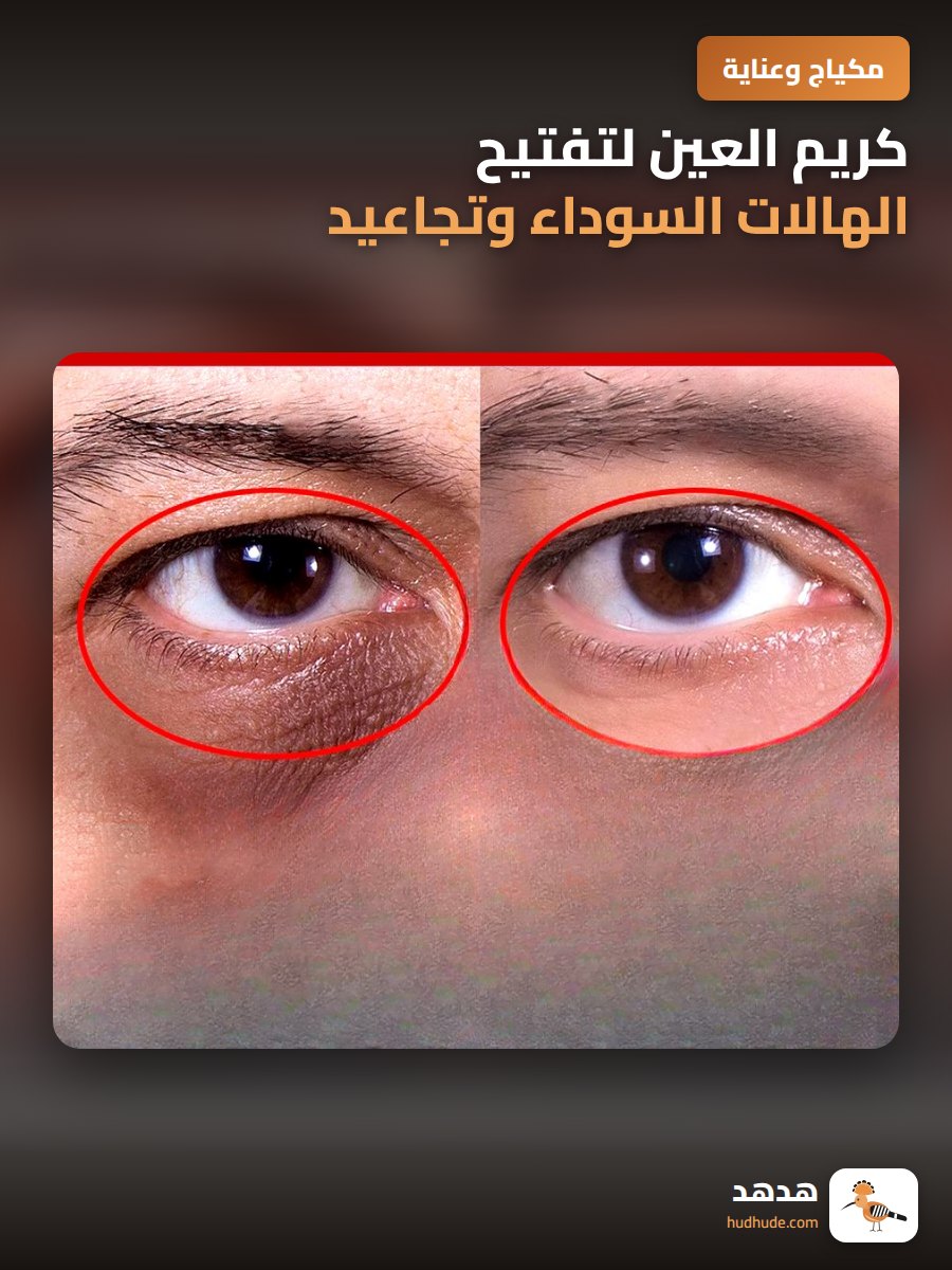 كريم العين لتفتيح الهالات السوداء وتجاعيد تحت العين بالجرانيول الفاخر